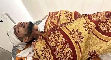 Arnavutköy'de Taksiye Çarpan Kamyonet Sürücüsü Kaçtı